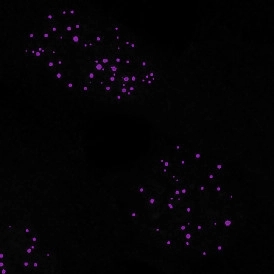 EBER ISH EBER ISHcells 274x274